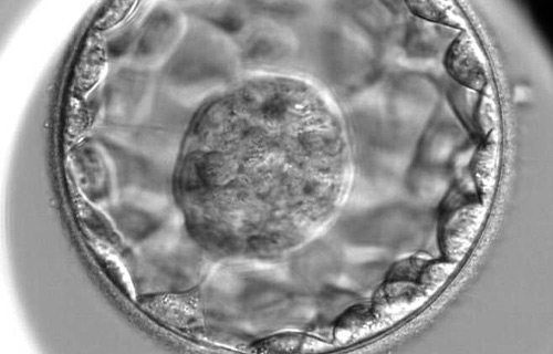 Il trasferimento di embrioni allo stadio di blastocisti migliora i tassi di gravidanza e di nati vivi nei trattamenti di ovodonazione