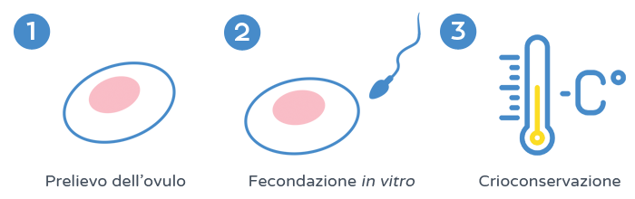 Preservazione della fertilità - Crioconservazione di embrioni