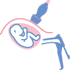 Diagnostica prenatale - Biopsia dei villi coriali